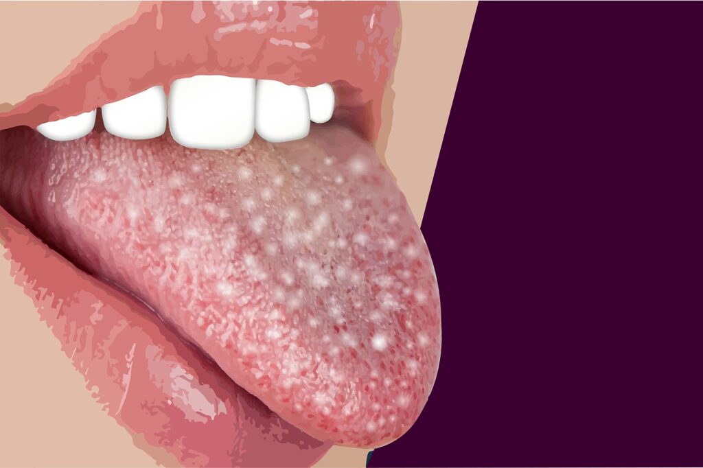 COVID Tongue Don t Ignore New Symptom In COVID Patients