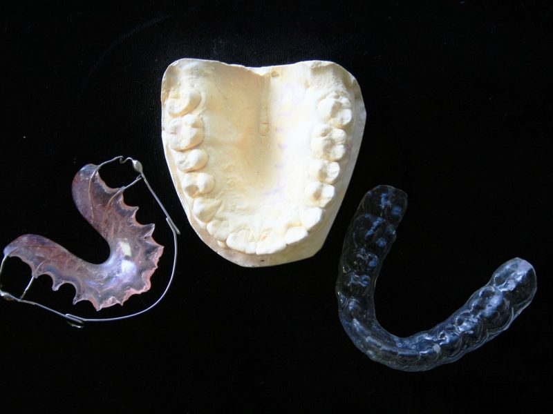 Role of retainers in orthodontic tretment