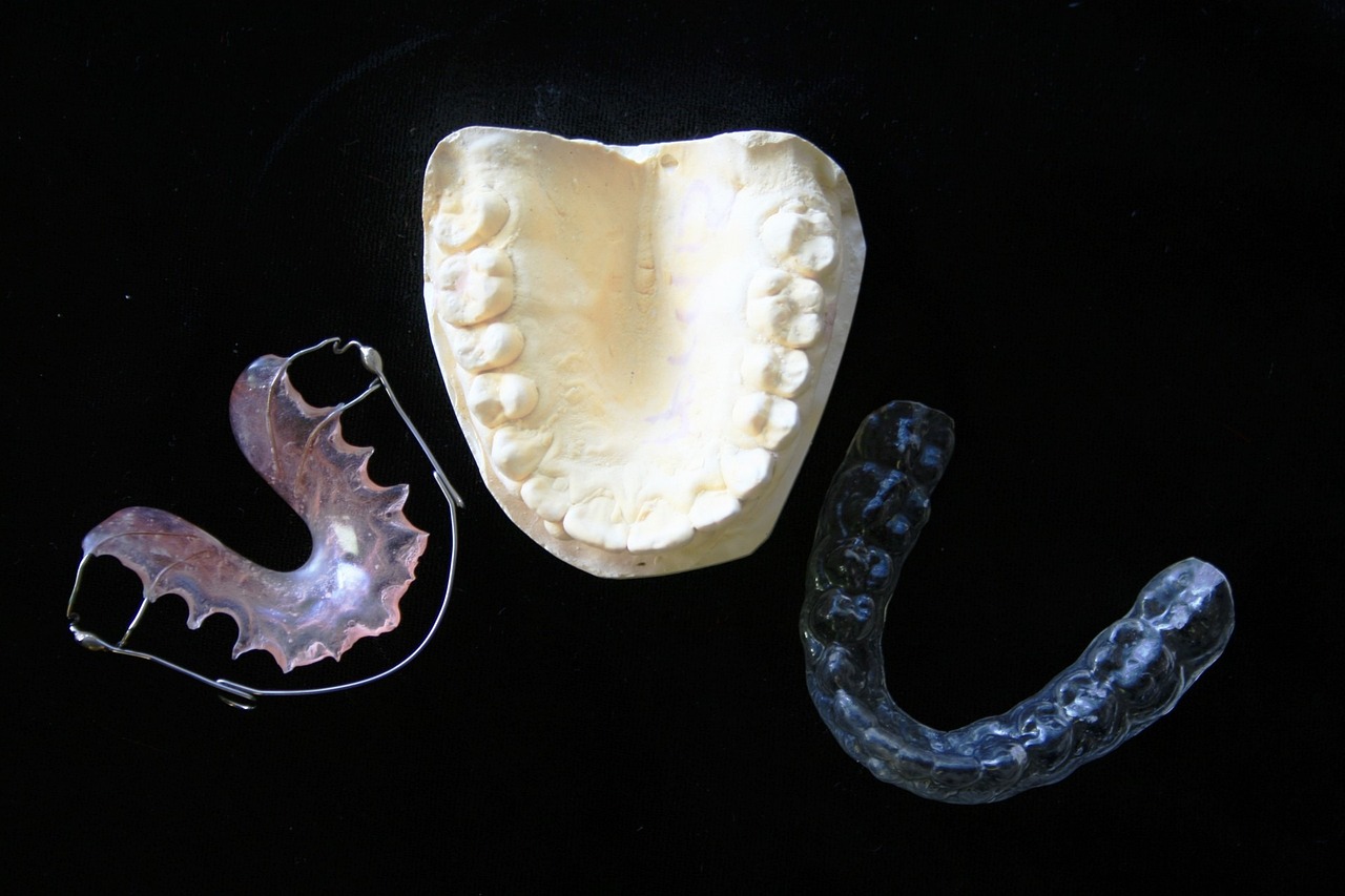 Dental Braces vs Clear Aligners